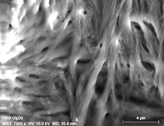 Collagen fibers